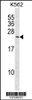 Western blot analysis in K562 cell line lysates (35ug/lane) .