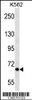 Western blot analysis in K562 cell line lysates (35ug/lane) .