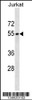 Western blot analysis in Jurkat cell line lysates (35ug/lane) .