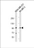 Western Blot at 1:1000 dilution Lane 1: MDA-MB-231 whole cell lysate Lane 2: SK-BR-3 whole cell lysate Lysates/proteins at 20 ug per lane.