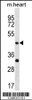 Western blot analysis in mouse heart tissue lysates (35ug/lane) .