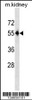 Western blot analysis in mouse kidney tissue lysates (35ug/lane) .