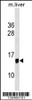 Western blot analysis in mouse liver tissue lysates (35ug/lane) .