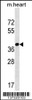 Western blot analysis in mouse heart tissue lysates (35ug/lane) .