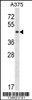 Western blot analysis in A375 cell line lysates (35ug/lane) .