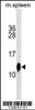 Western blot analysis in mouse spleen tissue lysates (35ug/lane) .