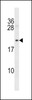 Western blot analysis in mouse bladder tissue lysates (35ug/lane) .This demonstrates detected the Mycb protein (arrow) .