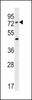 Western blot analysis in A549 cell line lysates (35ug/lane) .This demonstrates the ACSM2A antibody detected the ACSM2A protein (arrow) .