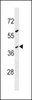 Western blot analysis in MDA-MB453 cell line lysates (35ug/lane) .