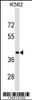 Western blot analysis in K562 cell line lysates (35ug/lane) .