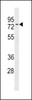 Western blot analysis in CEM cell line lysates (35ug/lane) .