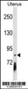 Western blot analysis in Uterus tissue lysates (35ug/lane) .