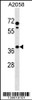 Western blot analysis in A2058 cell line lysates (35ug/lane) .