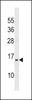 Western blot analysis in MDA-MB453 cell line lysates (35ug/lane) .