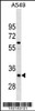 Western blot analysis in A549 cell line lysates (35ug/lane) .