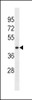 Western blot analysis in HepG2 cell line lysates (35ug/lane) .