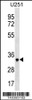 Western blot analysis in U251 cell line lysates (35ug/lane) .