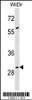 Western blot analysis in WiDr cell line lysates (35ug/lane) .