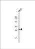 Western Blot at 1:1000 dilution + T47D whole cell lysate Lysates/proteins at 20 ug per lane.