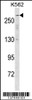 Western blot analysis in K562 cell line lysates (35ug/lane) .