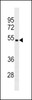 Western blot analysis in ZR-75-1 cell line lysates (35ug/lane) .