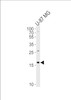 Western blot analysis of lysate from U-87 MG cell line, using CXCL2 Antibody at 1:1000 at each lane.