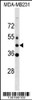 Western blot analysis in MDA-MB231 cell line lysates (35ug/lane) .