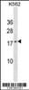 Western blot analysis in K562 cell line lysates (35ug/lane) .