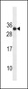 Western blot analysis in CEM cell line lysates (35ug/lane) .