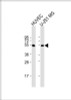 Western Blot at 1:1000 dilution Lane 1: HUVEC whole cell lysate Lane 2: U-251 MG whole cell lysate Lysates/proteins at 20 ug per lane.