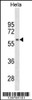 Western blot analysis in Hela cell line lysates (35ug/lane) .