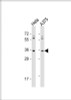 Western Blot at 1:1000 dilution Lane 1: Hela whole cell lysate Lane 2: A375 whole cell lysate Lysates/proteins at 20 ug per lane.