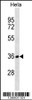 Western blot analysis in Hela cell line lysates (35ug/lane) .