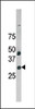 Western blot analysis of anti-NuBI-1 Pab in HepG2 cell line lysate.