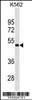 Western blot analysis in K562 cell line lysates (35ug/lane) .