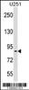 Western blot analysis in U251 cell line lysates (35ug/lane) .