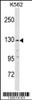 Western blot analysis in K562 cell line lysates (35ug/lane) .