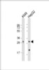 Western Blot at 1:1000 dilution Lane 1: A549 whole cell lysate Lane 2: HepG2 whole cell lysate Lysates/proteins at 20 ug per lane.