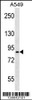 Western blot analysis in A549 cell line lysates (35ug/lane) .