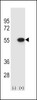 Western blot analysis of RUVBL2 using rabbit polyclonal RUVBL2 Antibody using 293 cell lysates (2 ug/lane) either nontransfected (Lane 1) or transiently transfected (Lane 2) with the RUVBL2 gene.