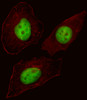 Fluorescent image of Hela cell stained with FOXN3 Antibody .Hela cells were fixed with 4% PFA (20 min) , permeabilized with Triton X-100 (0.1%, 10 min) , then incubated with FOXN3 primary antibody (1:25) . For secondary antibody, Alexa Fluor 488 conjugated donkey anti-rabbit antibody (green) was used (1:400) .Cytoplasmic actin was counterstained with Alexa Fluor 555 (red) conjugated Phalloidin (7units/ml) .FOXN3 immunoreactivity is localized to Nucleus significantly.