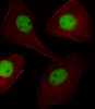 Fluorescent image of U251 cell stained with PGR/PR Antibody .U251 cells were fixed with 4% PFA (20 min) , permeabilized with Triton X-100 (0.1%, 10 min) , then incubated with PGR/PR primary antibody (1:25) . For secondary antibody, Alexa Fluor 488 conjugated donkey anti-rabbit antibody (green) was used (1:400) .Cytoplasmic actin was counterstained with Alexa Fluor 555 (red) conjugated Phalloidin (7units/ml) .PGR/PR immunoreactivity is localized to Nucleus significantly and Vesicles weakly.