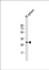 Western Blot at 1:2000 dilution + mouse spleen lysates Lysates/proteins at 20 ug per lane.