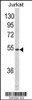 Western blot analysis of MFAP1 in Jurkat cell line lysates (35ug/lane)