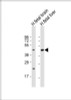 Western Blot at 1:2000 dilution Lane 1: human fetal brain lysate Lane 2: human fetal liver lysate Lysates/proteins at 20 ug per lane.