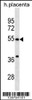 Western blot analysis in human placenta tissue lysates (35ug/lane) .