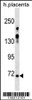 Western blot analysis in human placenta tissue lysates (35ug/lane) .