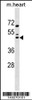 Western blot analysis in mouse heart tissue lysates (35ug/lane) .This demonstratedetected the Maf protein (arrow) .