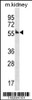 Western blot analysis in mouse kidney tissue lysates (35ug/lane) .