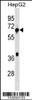 Western blot analysis in HepG2 cell line lysates (35ug/lane) .